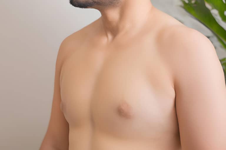 seek gynecomastia treatment