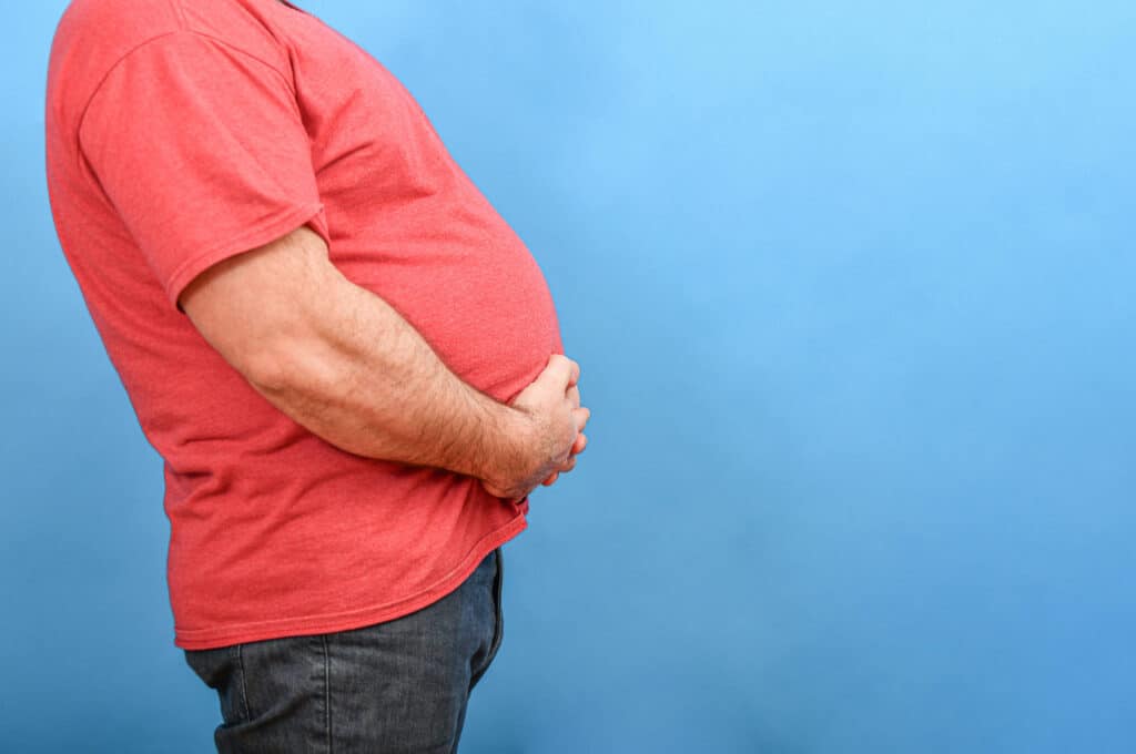 Gynecomastia cause - weight gain