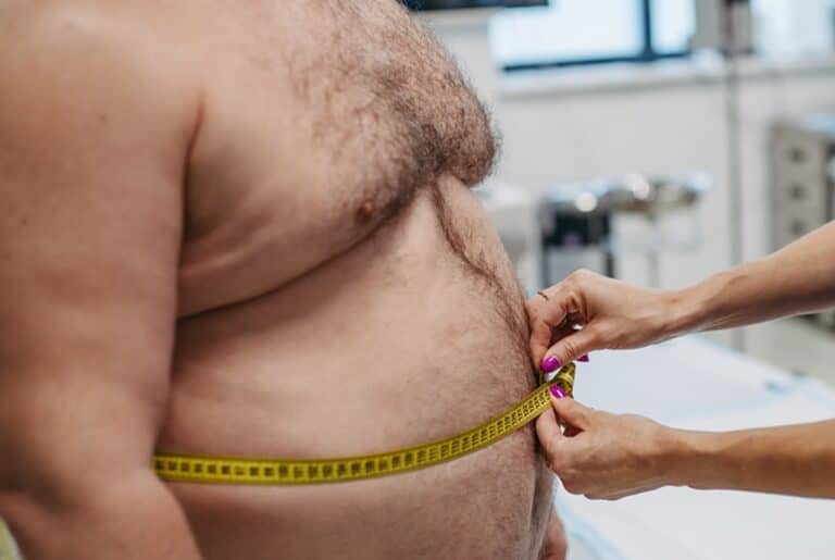 male patient with tape measure on belly