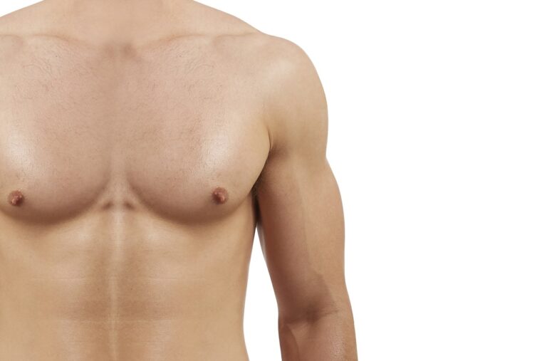 athletic male but has breast enlargement